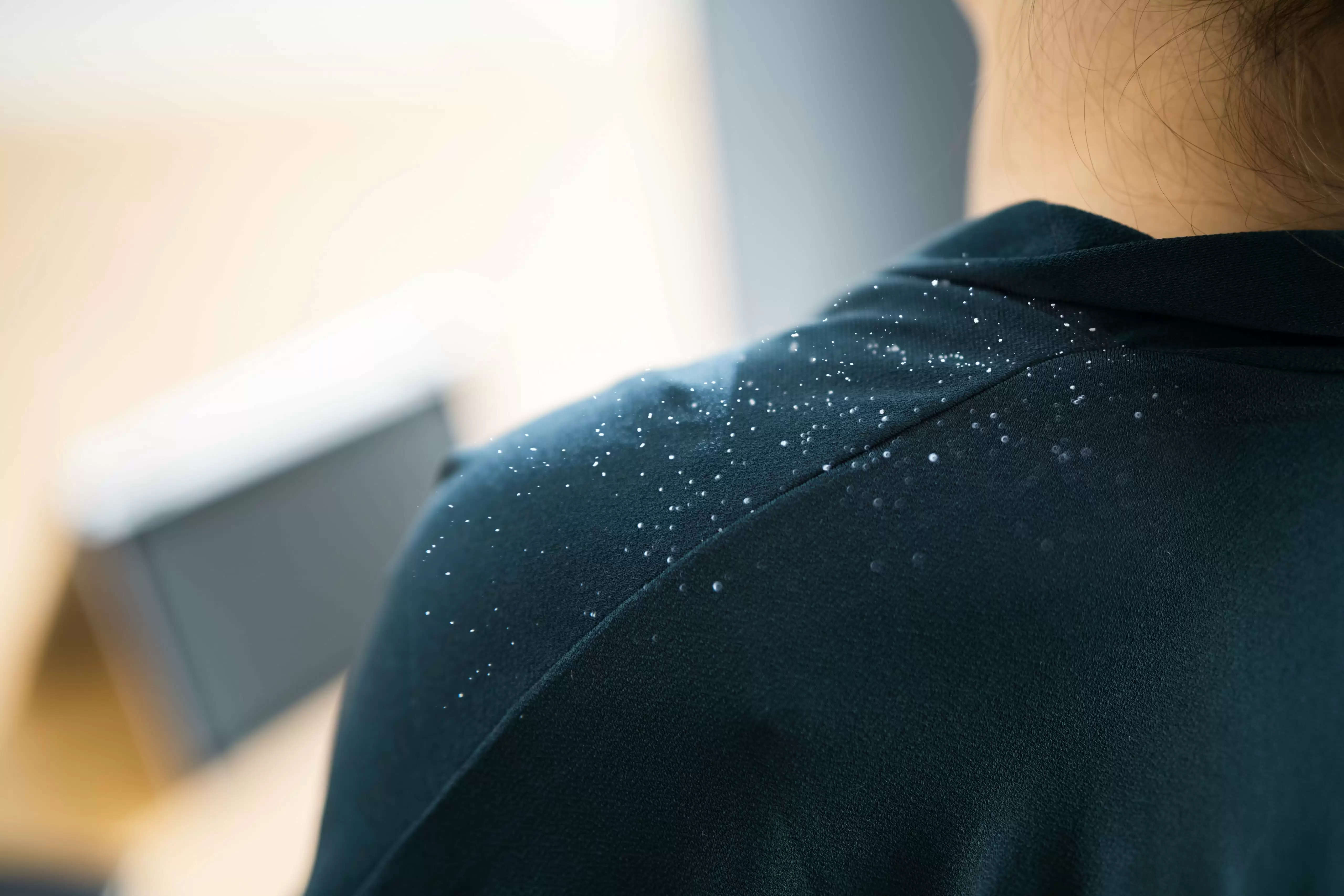 What Causes Dandruff And How To Get Rid Of It