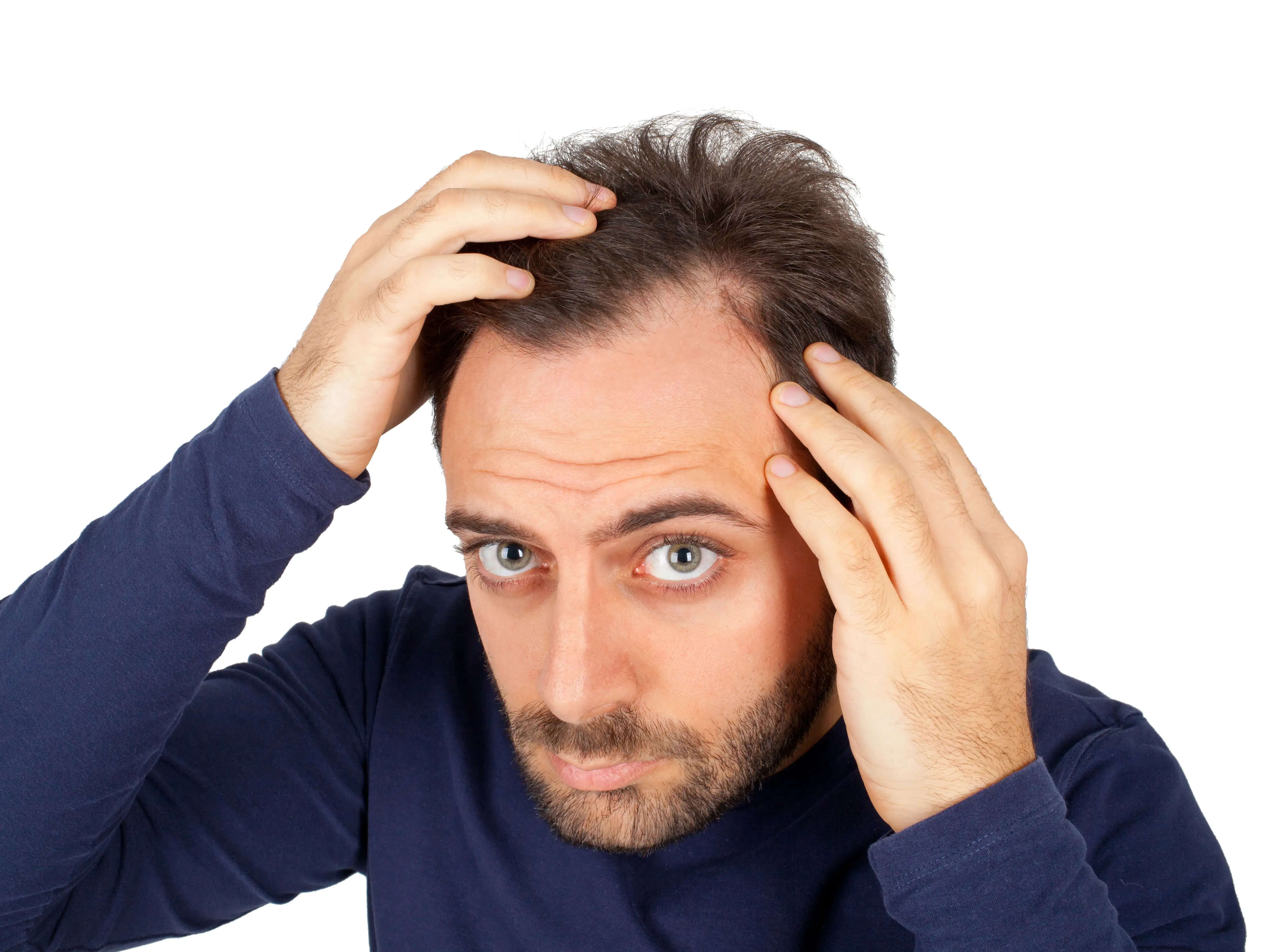 What is Finasteride and how does it help to reverse hair loss in men?