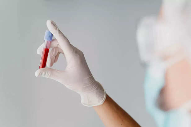 check your vitamin D ( im