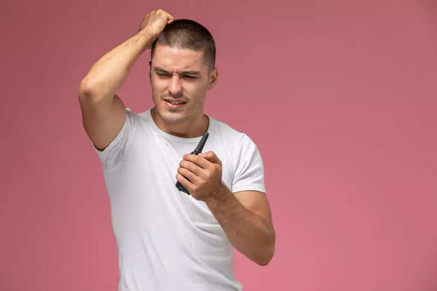 Male Hair Loss